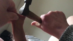 Large hammer in foreskin